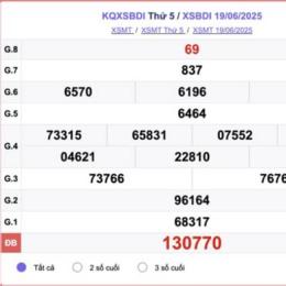 dự đoán kết quả xổ số bình định hôm nay